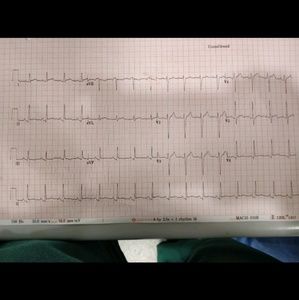 Meet your Posher, Eli